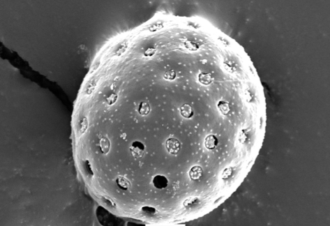 scanning electron micrograph image of a Chenopodiaceae pollen grain